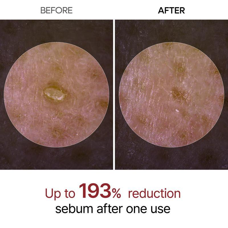Sale Happening Now:70%OFF🔥 Dr.Melaxin Peel Shot Glow Rice Ampoule Duo