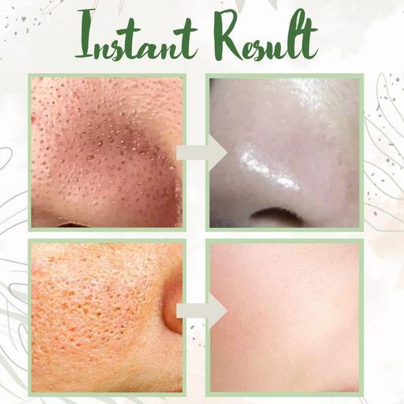 (🔥LAST DAY SALE-80% OFF)Final Sale -Insideefy Holy Basil Bubble Deep Mask 13%