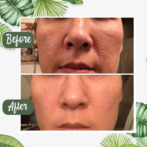 (🔥LAST DAY SALE-80% OFF)Final Sale -Insideefy Holy Basil Bubble Deep Mask 13%