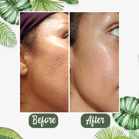 (🔥LAST DAY SALE-80% OFF)Final Sale -Insideefy Holy Basil Bubble Deep Mask 13%