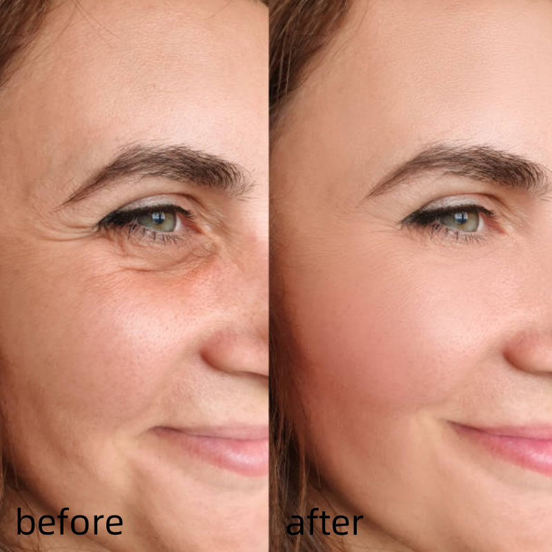 [Dr.Meloxin Official] ✨Cemenrete Calcium Multi Balm | Anti-aging, Sagging, Wrinkles | Korean Cosmetics💖