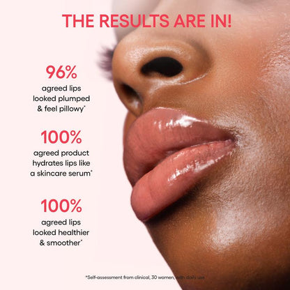 Final 3 Hours: 60%OFF🔥Donut-Inspired Lip Therapy from Korea